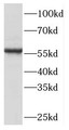 Western Blot