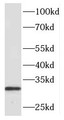 Western Blot