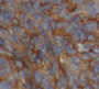 Immunohistochemistry