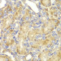 Immunohistochemistry