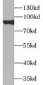 Western Blot