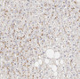 Immunohistochemistry