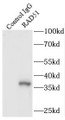 Immunoprecipitation