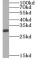 Western Blot