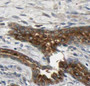 Immunohistochemistry