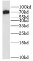 Western Blot