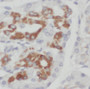 Immunohistochemistry