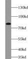 Western Blot