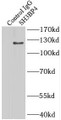 Immunoprecipitation