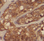 Immunohistochemistry