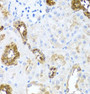 Immunohistochemistry