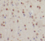 Immunohistochemistry