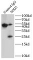 Immunoprecipitation