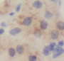 Immunohistochemistry