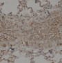 Immunohistochemistry