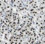 Immunohistochemistry