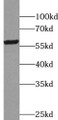 Western Blot