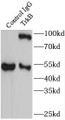 Immunoprecipitation