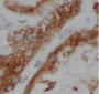 Immunohistochemistry