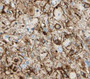 Immunohistochemistry