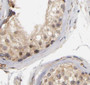 Immunohistochemistry