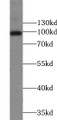 Western Blot