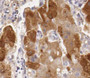 Immunohistochemistry