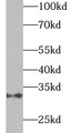 Western Blot