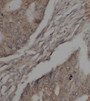 Immunohistochemistry