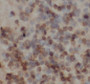 Immunohistochemistry