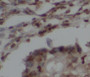 Immunohistochemistry