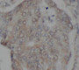 Immunohistochemistry