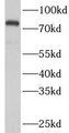 Western Blot