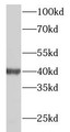 Western Blot