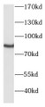 Western Blot