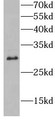 Western Blot