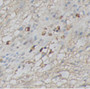 Immunohistochemistry