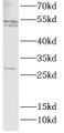 Western Blot