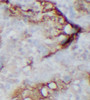 Immunohistochemistry