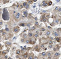 Immunohistochemistry