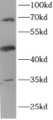 Western Blot