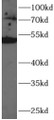 Western Blot