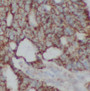 Immunohistochemistry