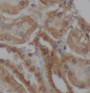 Immunohistochemistry