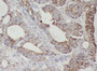 Immunohistochemistry