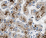 Immunohistochemistry