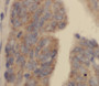 Immunohistochemistry