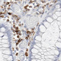 Immunohistochemistry