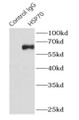 Immunoprecipitation