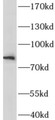 Western Blot